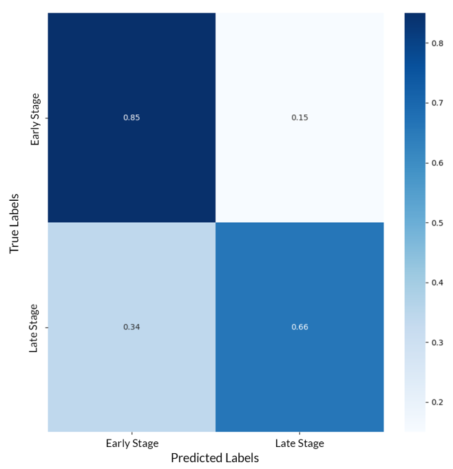 Confusion matrix for early stage versus late stage DR classification