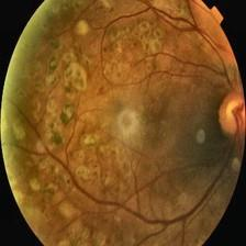 Fundus image with CLAHE contrast enhancement applied