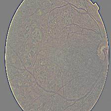Fundus image with a Gaussian filter applied