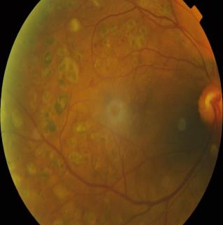 Original unfiltered fundus image